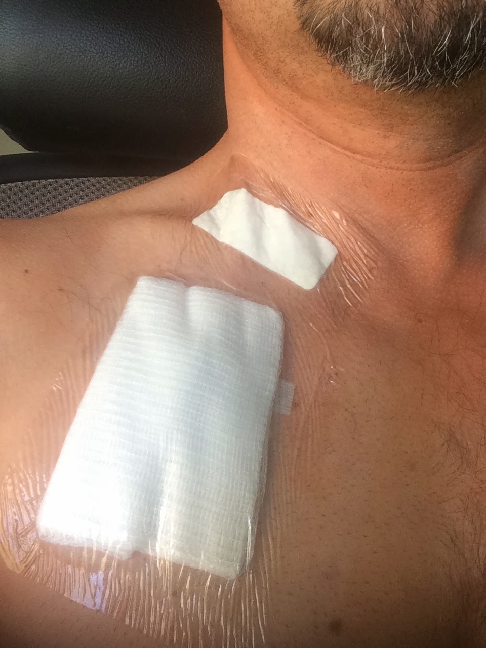 Queasy Writer Mediports and Football Thursday's Procedures, Part II